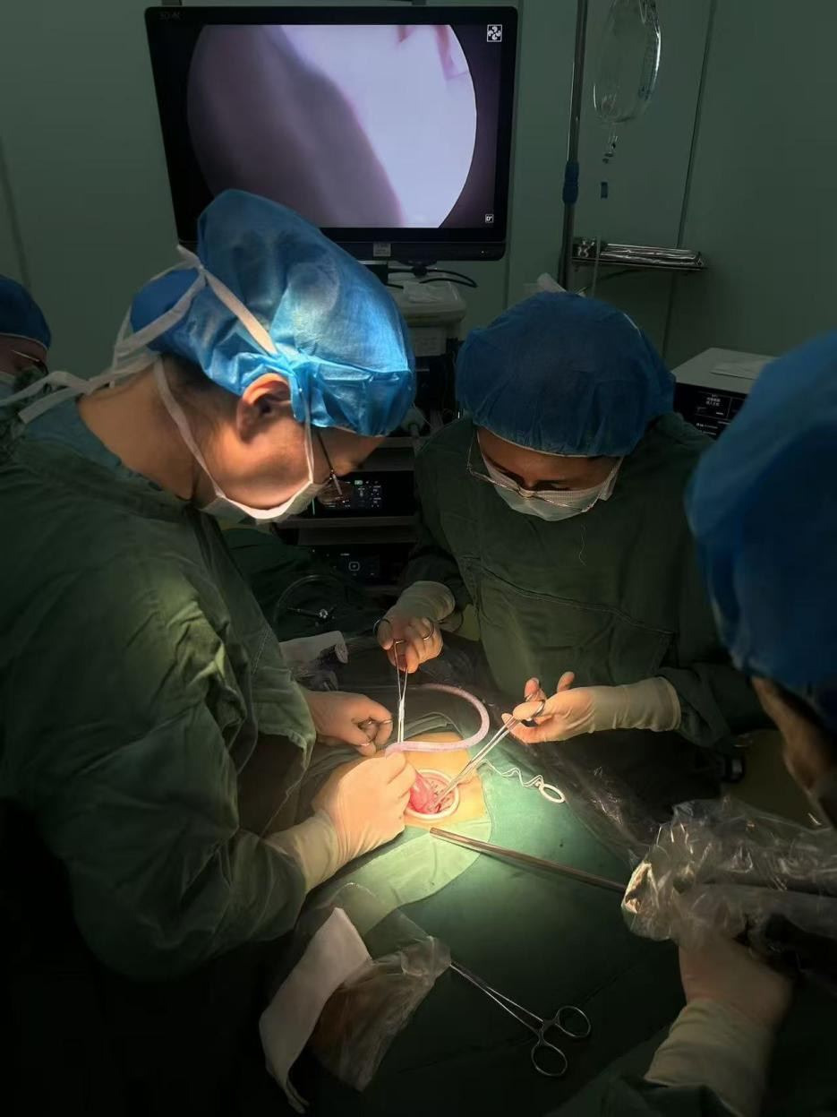 刘国艳(右)正在进行单孔腹腔镜下卵巢肿瘤剥除术带教。受访者供图