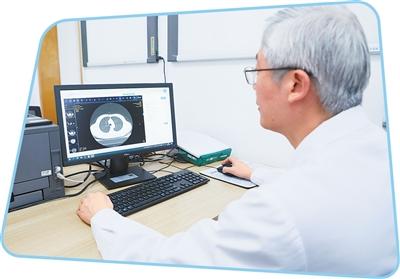 江苏省肿瘤医院胸外科主任医师李明在用云影像看诊。吴梦然摄